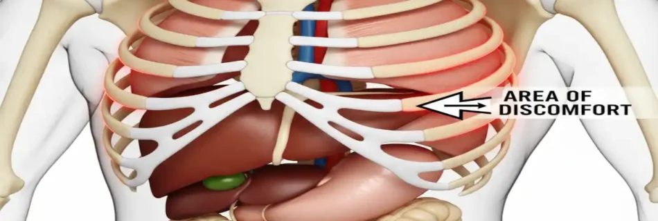 Sore Back Under Ribs Right Side: 15+ Causes, Symptoms, Relief Strategies & Red Flags