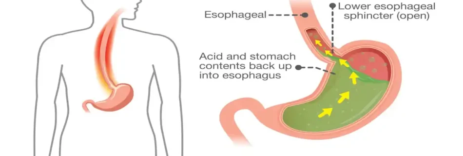 The Manometry Test: Complete Insights for Better Digestion