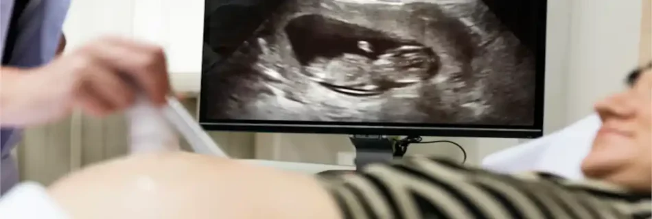 Appendicitis Ultrasound: Complete Diagnostic Guide