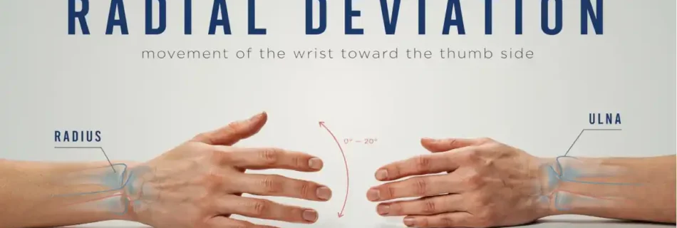Radial Deviation: Understanding Its Function, Causes, Symptoms, Diagnosis, and Treatment