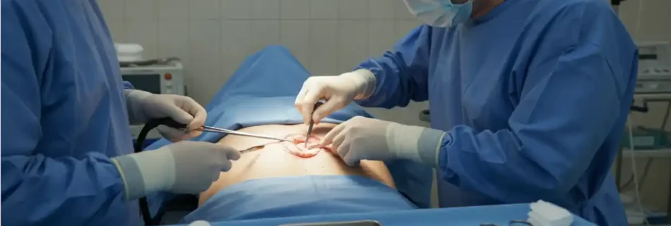 Operation to Remove Cyst: Everything You Need to Know