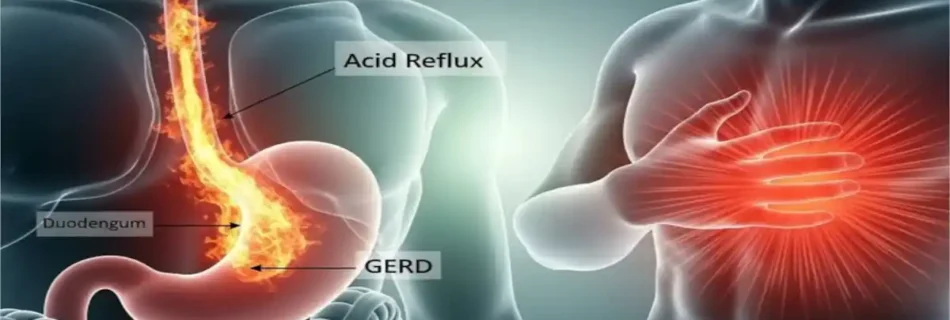 Constant Heartburn: Causes, Relief, and Long-Term Management