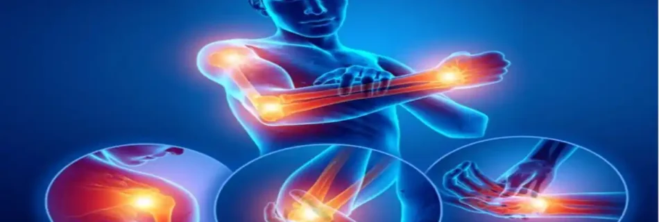 Fracture and a Break: Understanding the Difference, Causes, Treatment, and Recovery