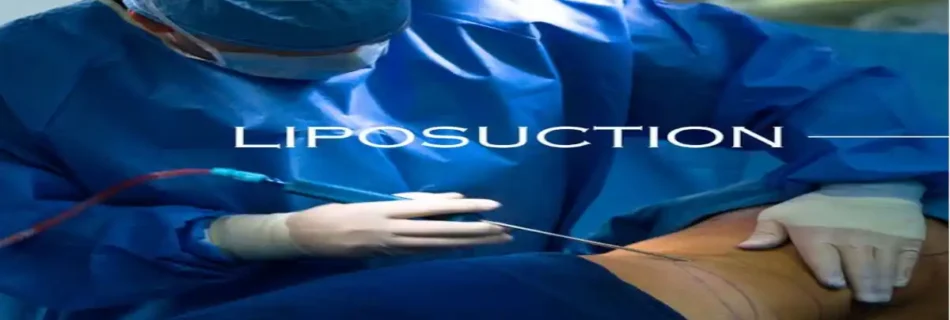 Liposculpture Liposuction: Complete Guide to Body Contouring