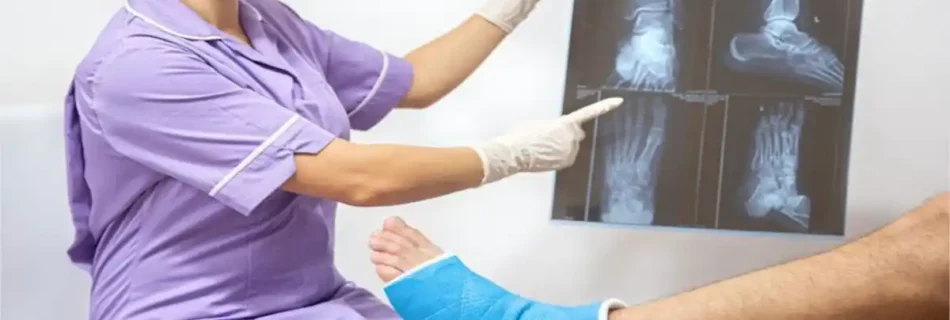 Simple Fracture: Complete Guide to Symptoms, Treatment, and Recovery