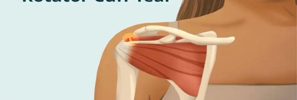 What Does a Torn Rotator Cuff Feel Like? A Complete Guide